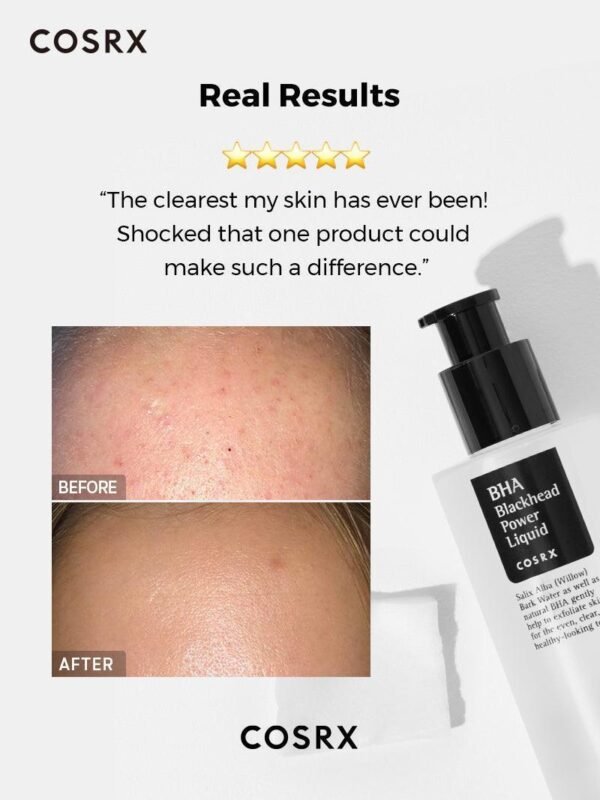 BHA Blackhead Power Liquid - Image 3