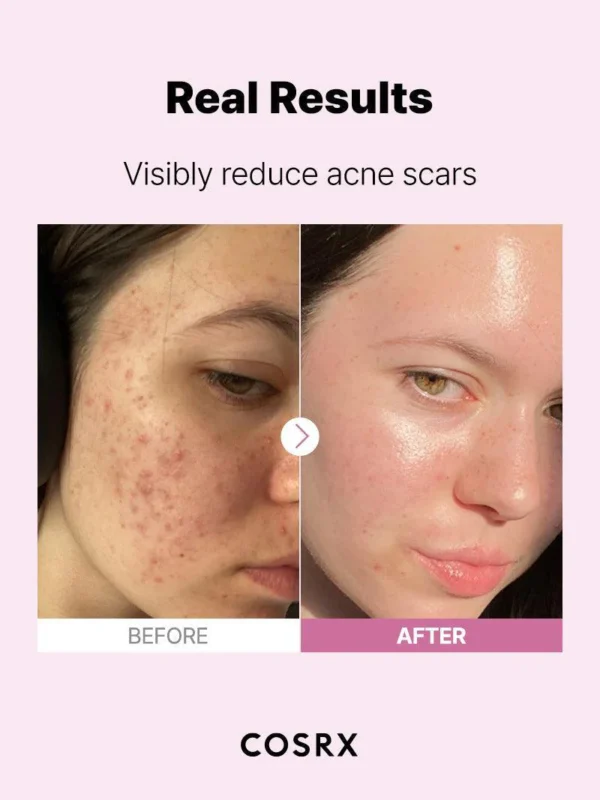 The Niacinamide 15 Serum - Image 8