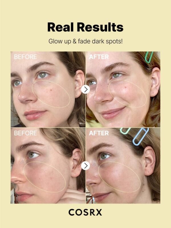 The Vitamin C 23 Serum - Image 10